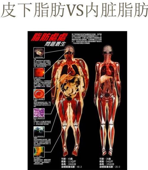 1药网内脏脂肪长在身体哪些地方危害最大如何科学合理地减掉