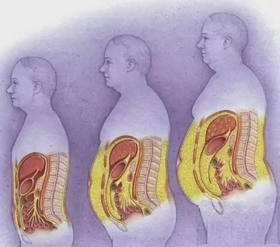 1药网内脏脂肪长在身体哪些地方危害最大如何科学合理地减掉