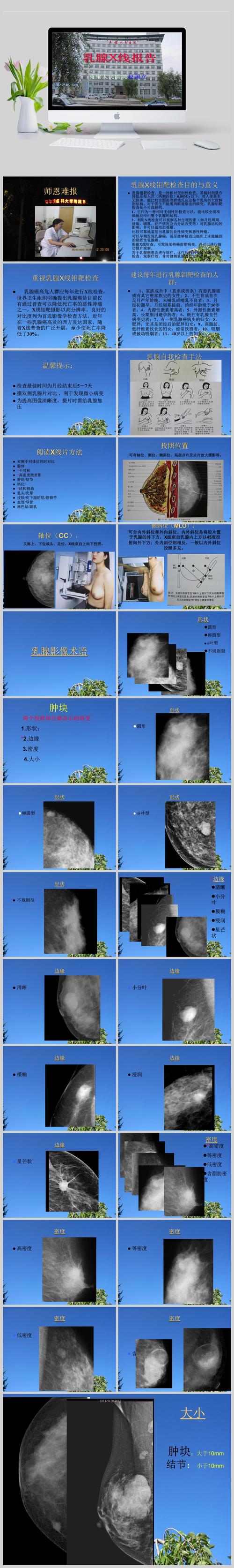 【健康小课堂】钼靶检查如何做教你一文读懂乳腺钼靶