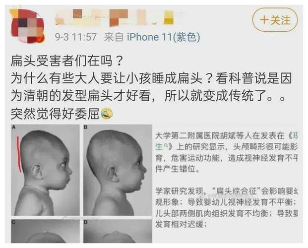 宝宝头型圆润才好看小时候把女儿睡成扁头了妈妈该怎么解释