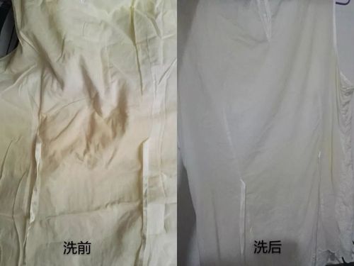 白衣服发黄怎么洗_白衣服发黄怎么洗可以变白