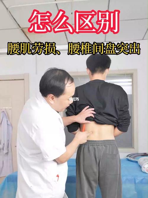 腰肌劳损怎么办_腰肌劳损怎么办恢复快