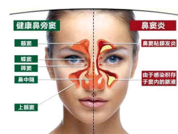 鼻子不通气是怎么回事_右鼻子不通气什么原因