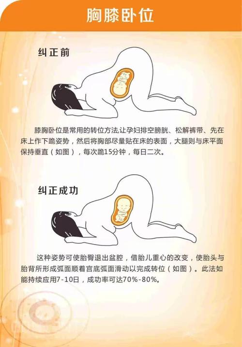 胎位不正怎么纠正_胎位不正怎么纠正过来