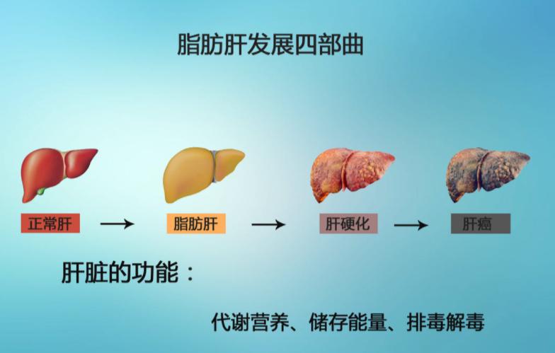 如何治疗脂肪肝_如何治疗脂肪肝最好