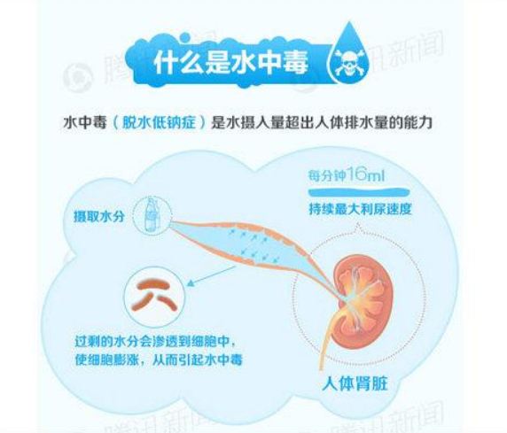 喝多少水会水中毒_喝多少水会水中毒是什么症状