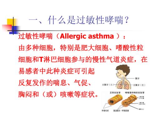 过敏性哮喘病_过敏性哮喘病的最好治疗方法