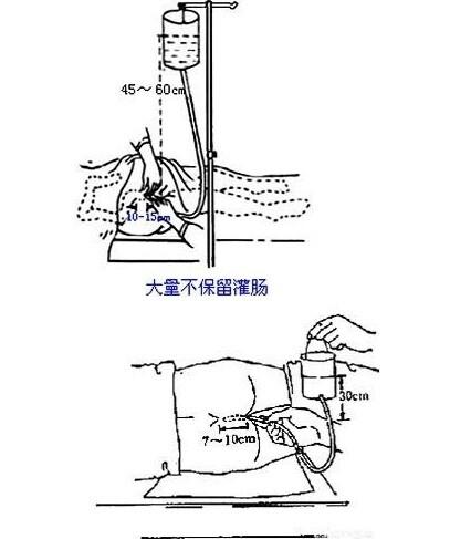 灌肠好不好_四岁宝宝发烧灌肠好不好