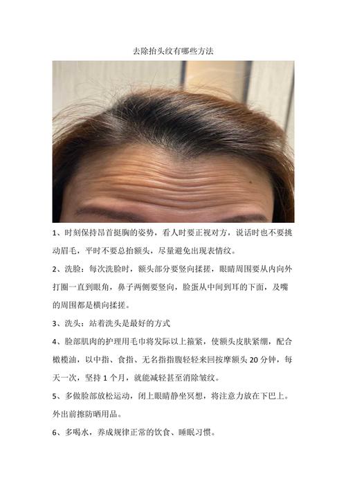 如何去抬头纹_如何去抬头纹最好的方法