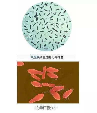 肉毒杆菌是什么_肉毒杆菌是什么细菌