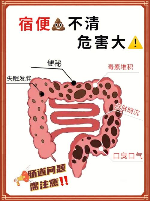 清宿便最有效的方法_怎么清宿便最有效的方法