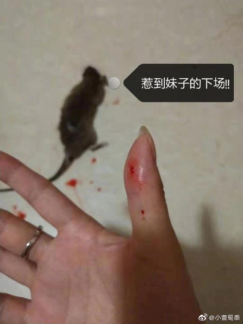 被老鼠咬了怎么办_被老鼠咬了怎么办出血