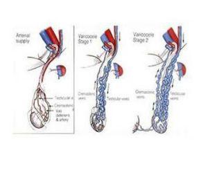 睾丸结构图_飞机打多了引起精索静脉曲张