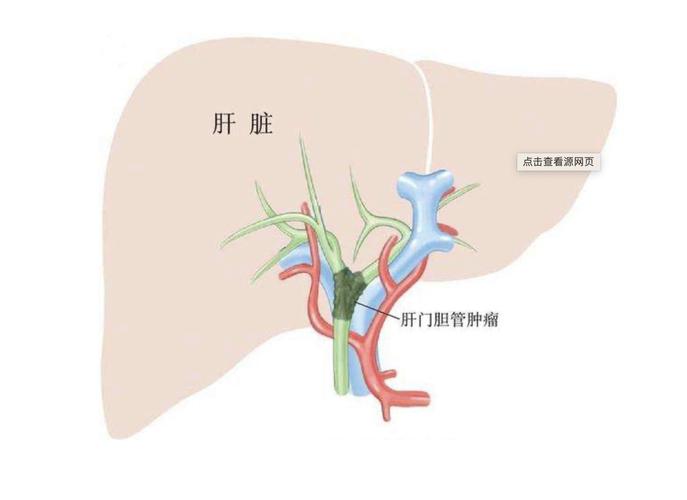 肝胆_肝胆挂什么科