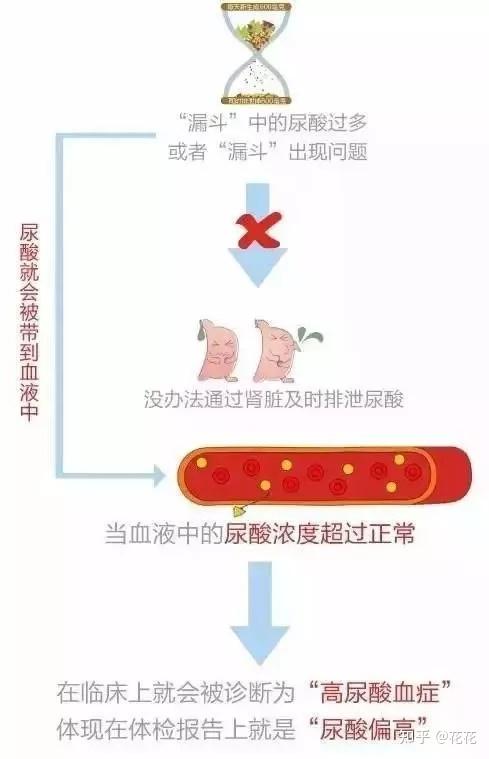 尿酸高是怎么回事_尿酸高是怎么回事是什么引起的