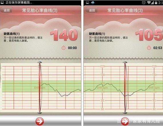 胎心率多少正常_胎心率多少正常范围