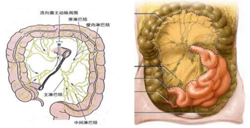 肠系膜淋巴结结核_肠系膜淋巴结结核症状