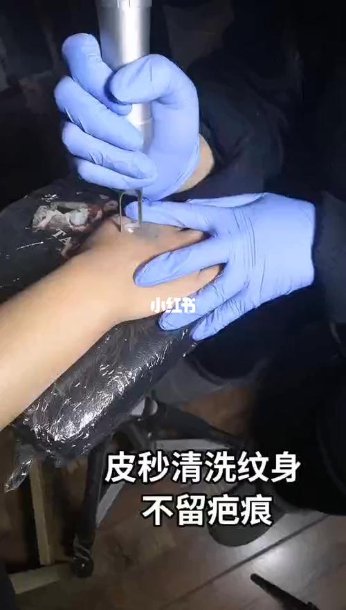 怎样清洗纹身_怎样清洗纹身不留疤