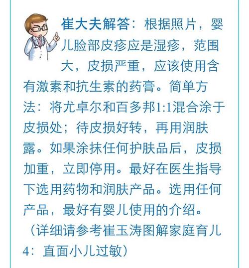 宝宝湿疹偏方_治疗婴儿湿疹民间偏方