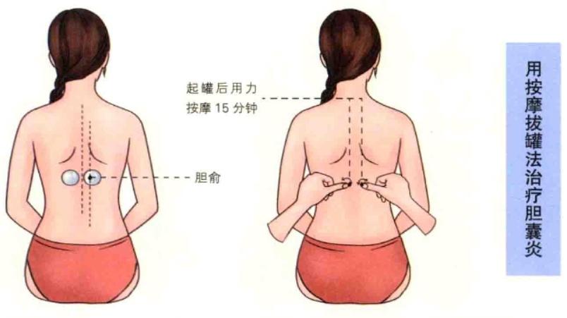 胆囊炎症状疼痛位置图_胆囊炎症状疼痛位置图后背疼