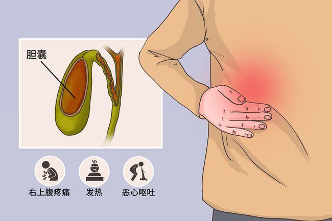 胆囊炎症状疼痛位置图_胆囊炎症状疼痛位置图后背疼