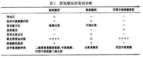 氨基酸尿_氨基酸尿有什么症状