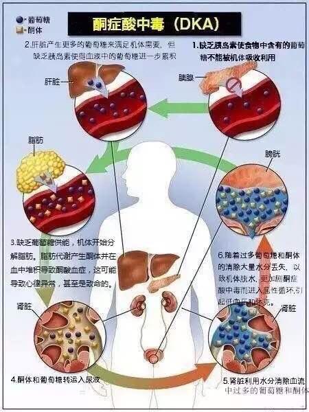 氨基酸尿_氨基酸尿有什么症状