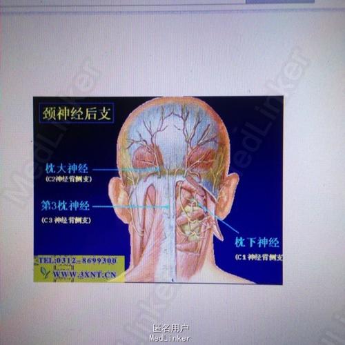 枕大神经痛_枕大神经痛的症状有哪些