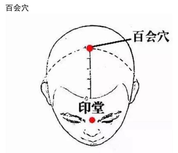 百会_百会的准确位置图