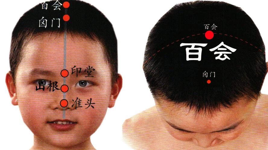 百会_百会的准确位置图