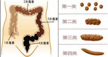 宿便怎么排_宿便怎么排出来