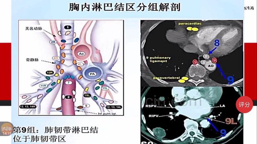 肺门淋巴结核_小儿肺门淋巴结核