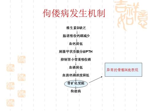 佝偻病的病因_佝偻病的病因主要是