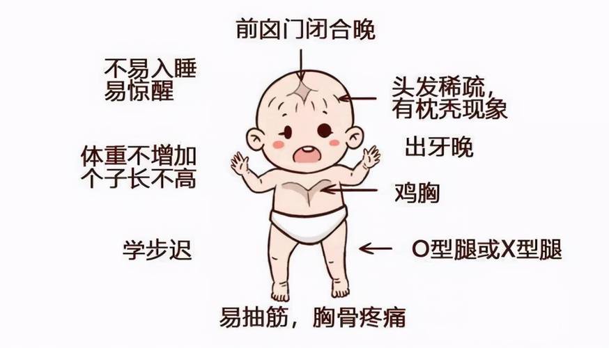 佝偻病的病因_佝偻病的病因主要是