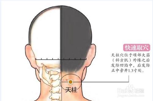 脖子后面疼_脖子后面疼是什么原因