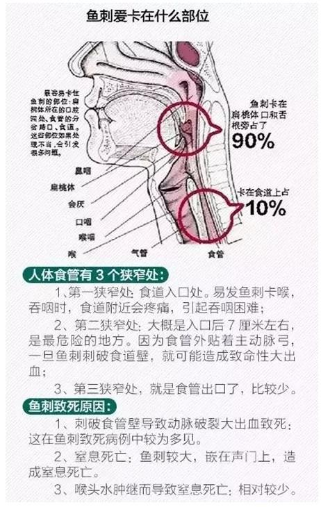 鱼刺卡喉咙怎么办_鱼刺卡喉咙怎么办最快速最有效