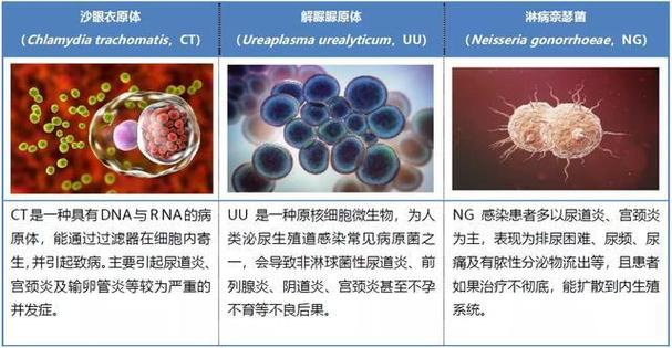 妇科支原体感染原因_妇科支原体感染原因引起的