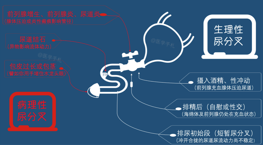 小便分叉的原因_小便分叉的原因是什么