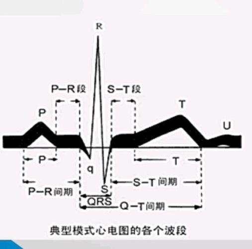 心电图怎么看_心电图怎么看图解