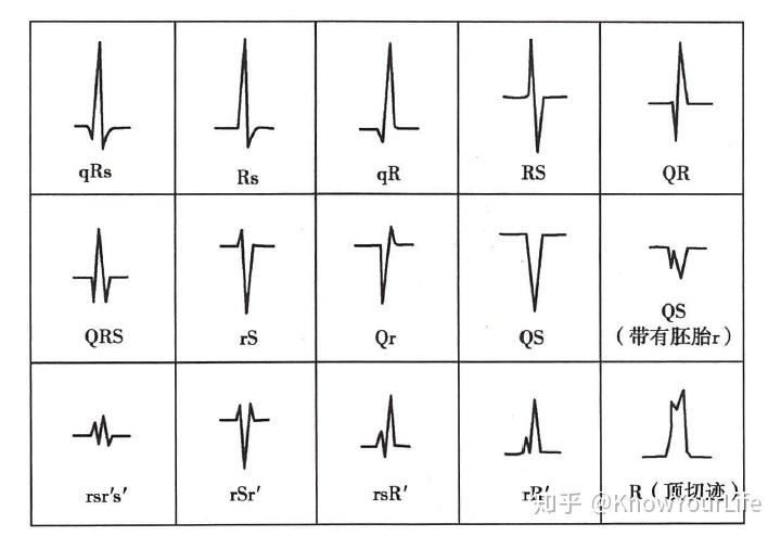心电图怎么看_心电图怎么看图解