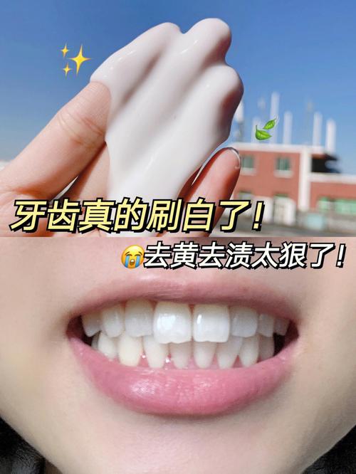 牙齿黄能洗白吗_牙齿黄能洗白吗怎么洗