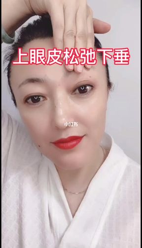 眼部松弛_眼部松弛怎么解决