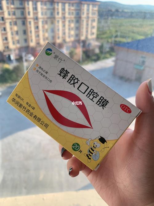 口腔溃疡吃什么好_舌头上口腔溃疡吃什么好