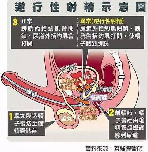 不射精怎么办_不排精怎么办