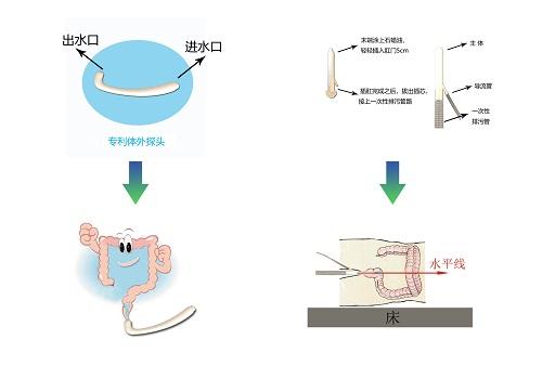 如何洗肠_如何洗肠才能洗干净